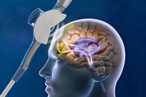 Beynin Gücüyle Depresyona Meydan Okuma